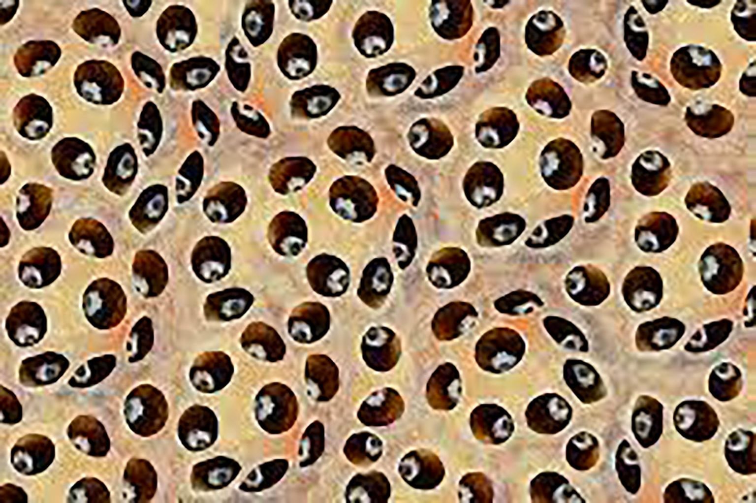 Trypophobia Symptoms Causes And Therapy 3641